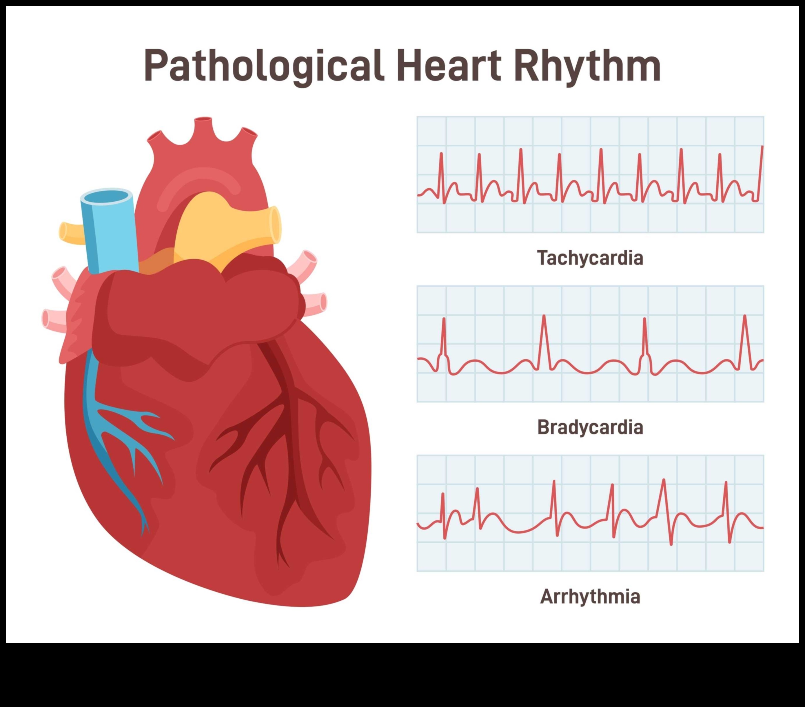 Heartbeat Harmony: Dengeli Bir Yaşam İçin Kardiyovasküler Egzersizler